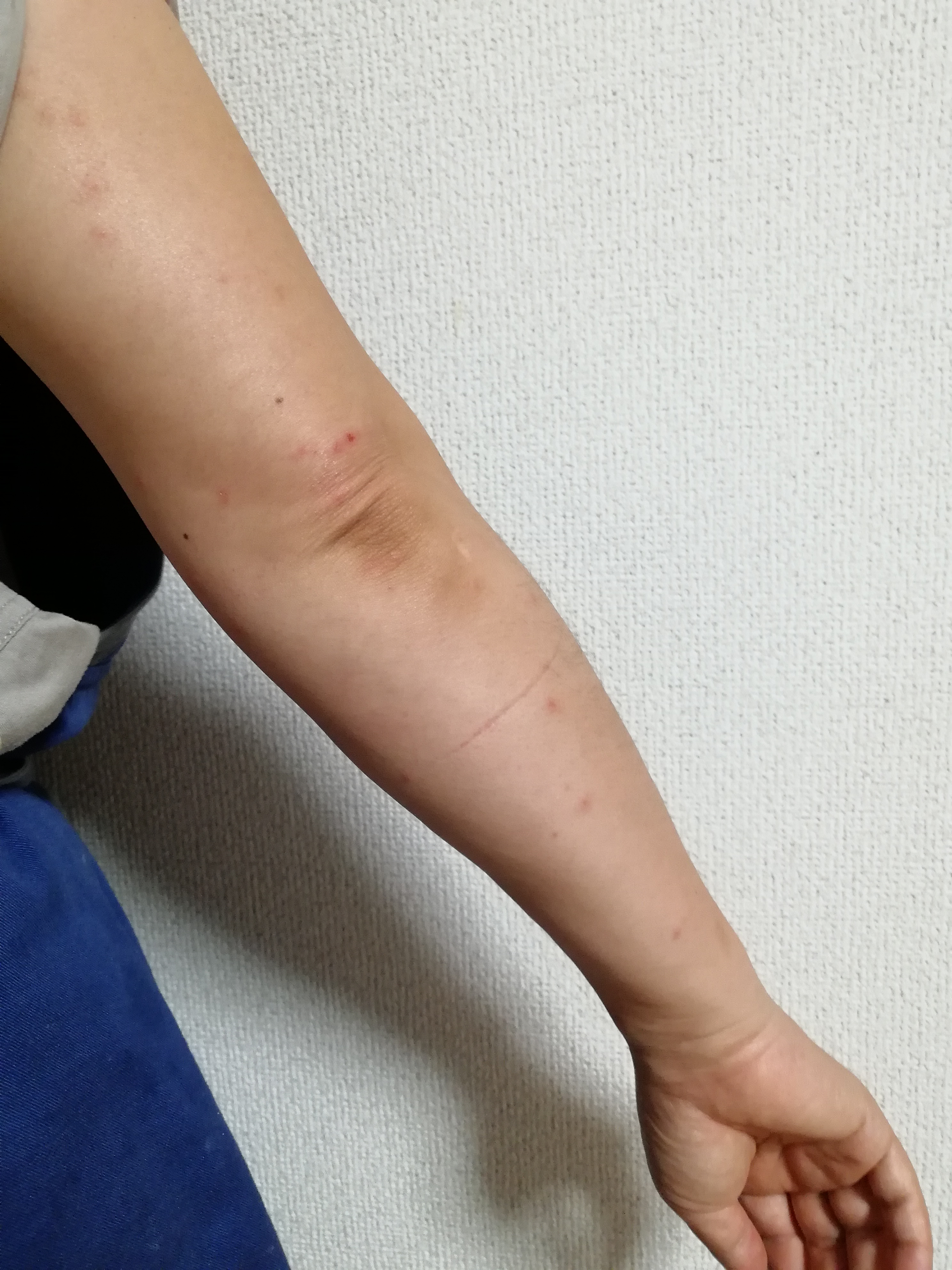 腕 腕